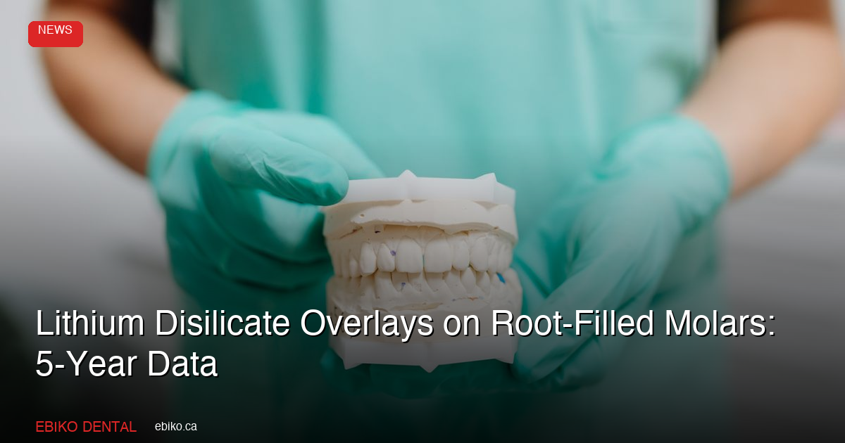 Lithium Disilicate Overlays on Root-Filled Molars: 5-Year Data - EBIKO Dental Blog