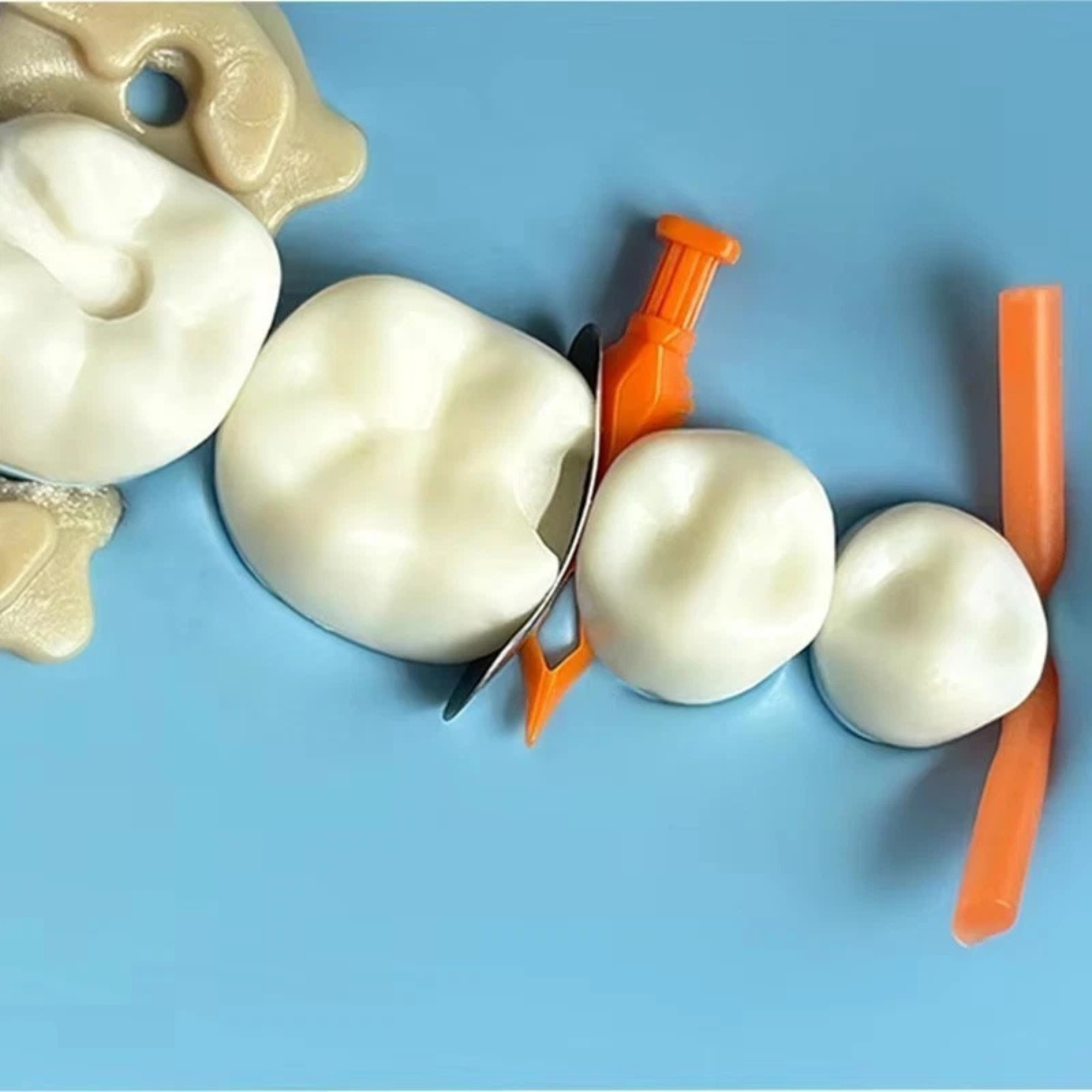 Diamond Wedge, Color Coded, 40/Box