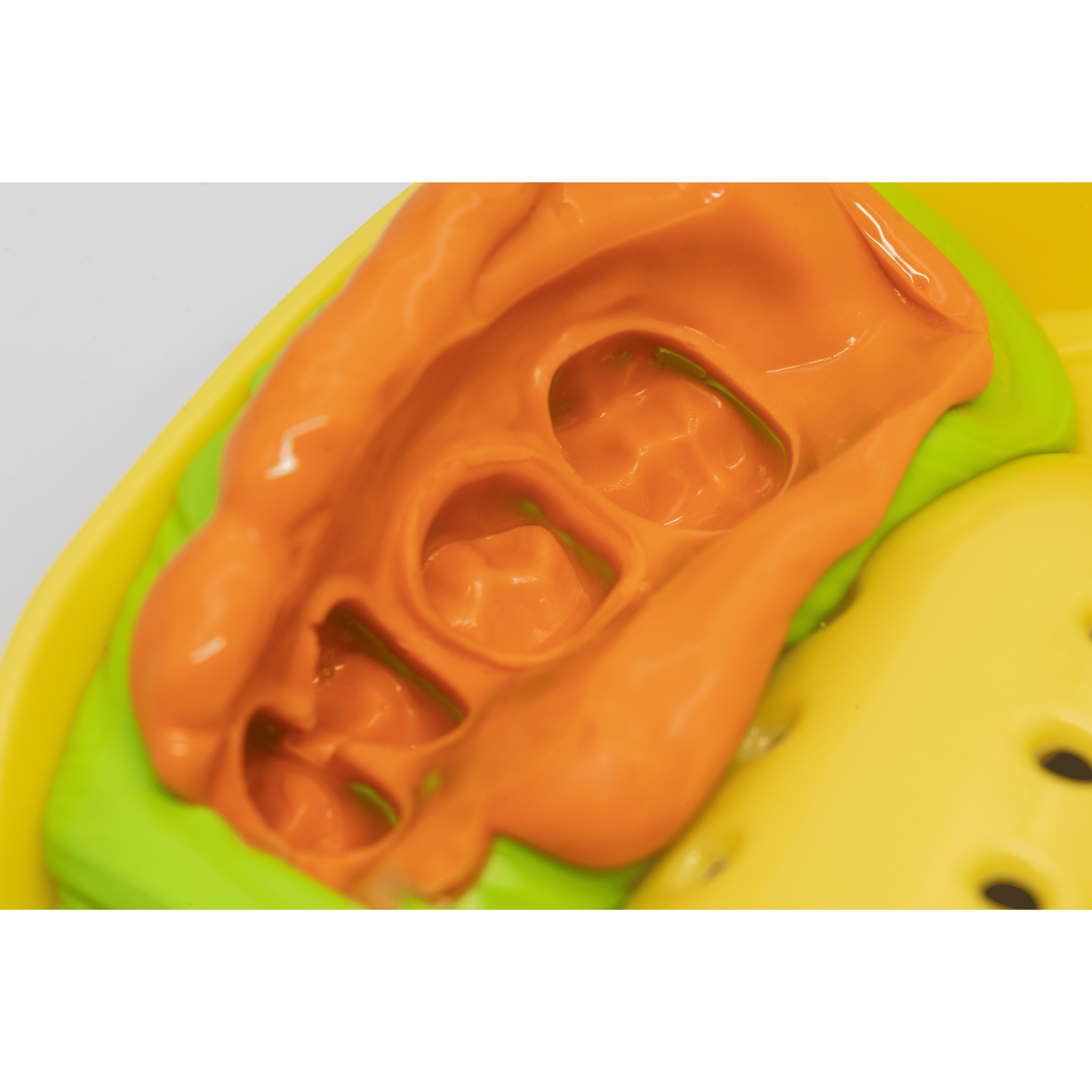 PERFIT Light Body Elastomeric Impression Material – Normal Set or Fast Set, 50 mL × 2 Cartridges