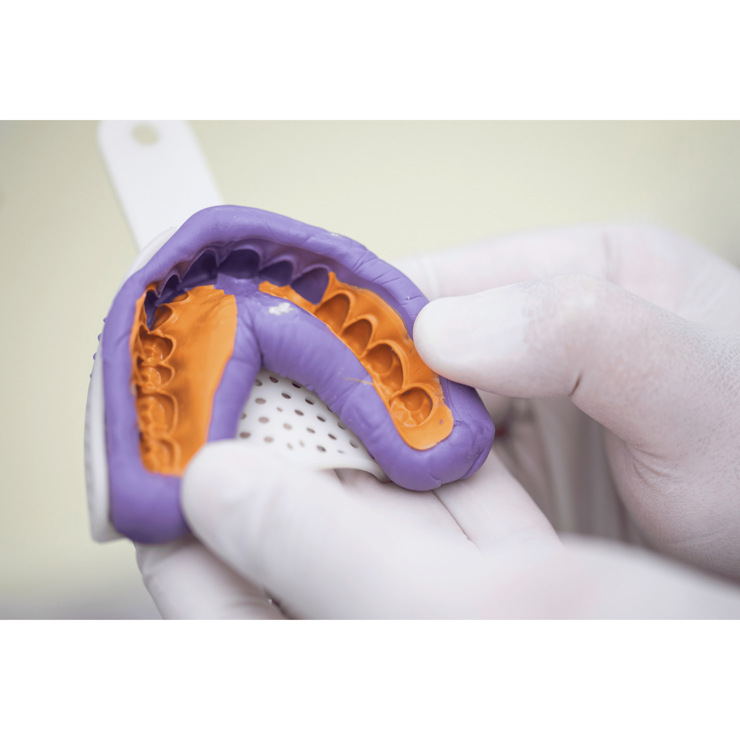 PERFIT Light Body Elastomeric Impression Material – Normal Set or Fast Set, 50 mL × 2 Cartridges