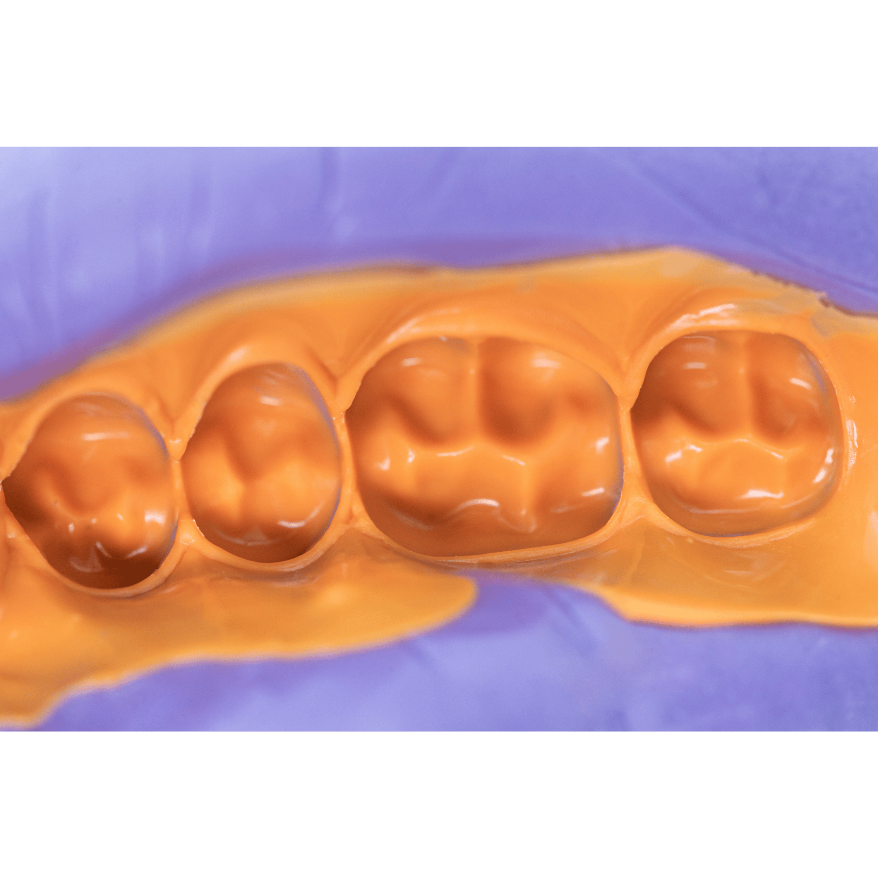 PERFIT Light Body Elastomeric Impression Material – Normal Set or Fast Set, 50 mL × 2 Cartridges