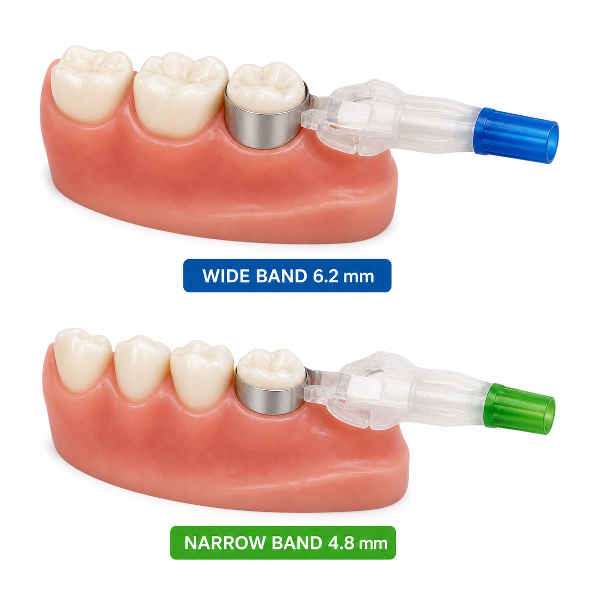 EBIKO Dental Disposable Retainer Matrix – Wide & Narrow Band 20pcs/Box