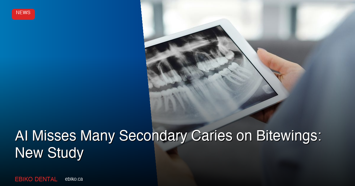 AI Misses Many Secondary Caries on Bitewings: New Study - EBIKO Dental Blog