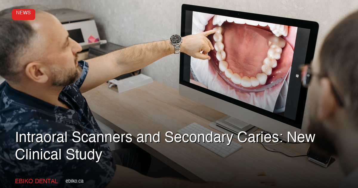 Intraoral Scanners and Secondary Caries: New Clinical Study - EBIKO Dental Blog