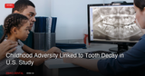 Childhood Adversity Linked to Tooth Decay in U.S. Study