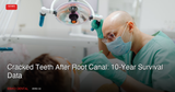 Cracked Teeth After Root Canal: 10-Year Survival Data