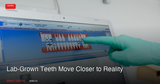 Laboratory-Grown Teeth Move Closer to Reality as King's College Hydrogel Breakthrough Advances Regenerative Dentistry