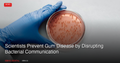 Scientists Prevent Gum Disease by Disrupting Bacterial Communication in New 2026 Study