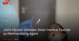 JADA Review Validates Silver Diamine Fluoride as Enamel and Dentin Remineralizing Agent in July 2026