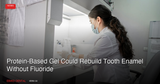 Protein-Based Gel Could Rebuild Tooth Enamel Without Fluoride, Nottingham Researchers Report