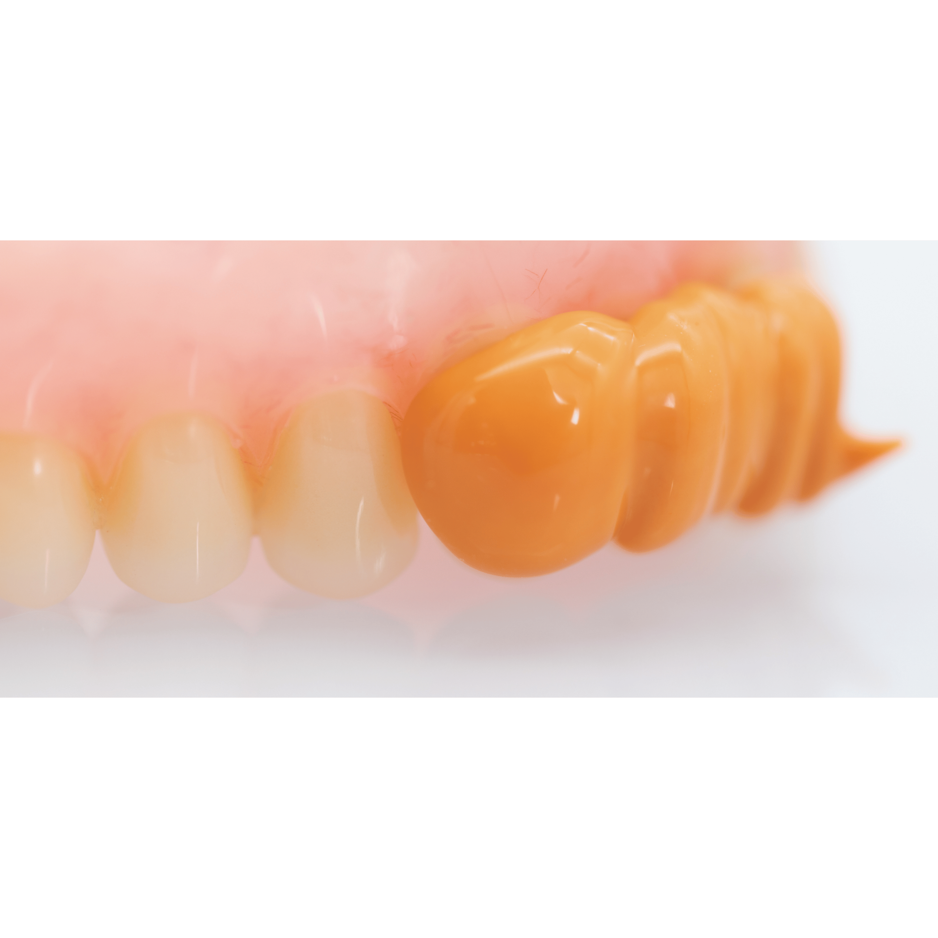 PERFIT Light Body Elastomeric Impression Material – Normal Set or Fast Set, 50 mL × 2 Cartridges