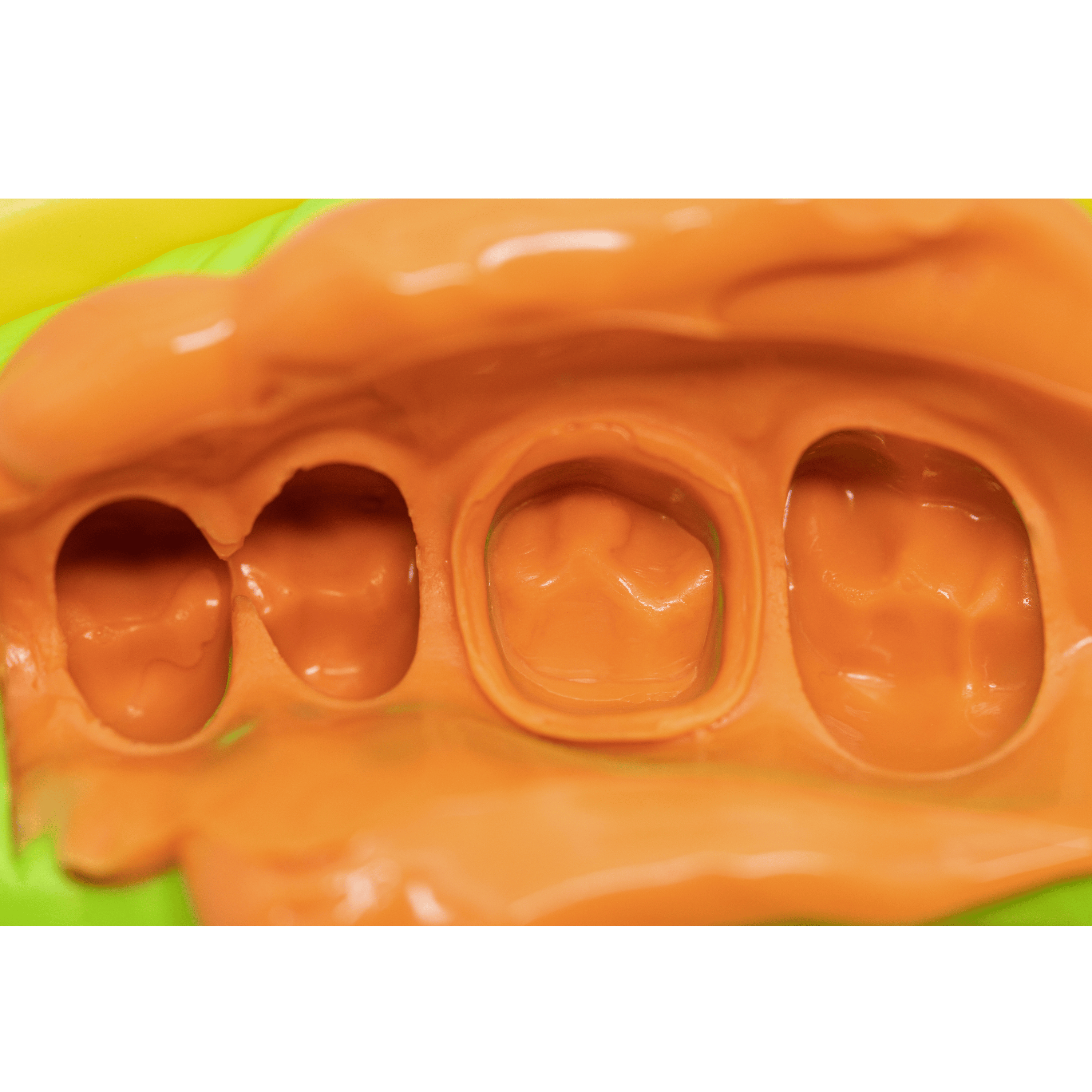 PERFIT Light Body Elastomeric Impression Material – Normal Set or Fast Set, 50 mL × 2 Cartridges