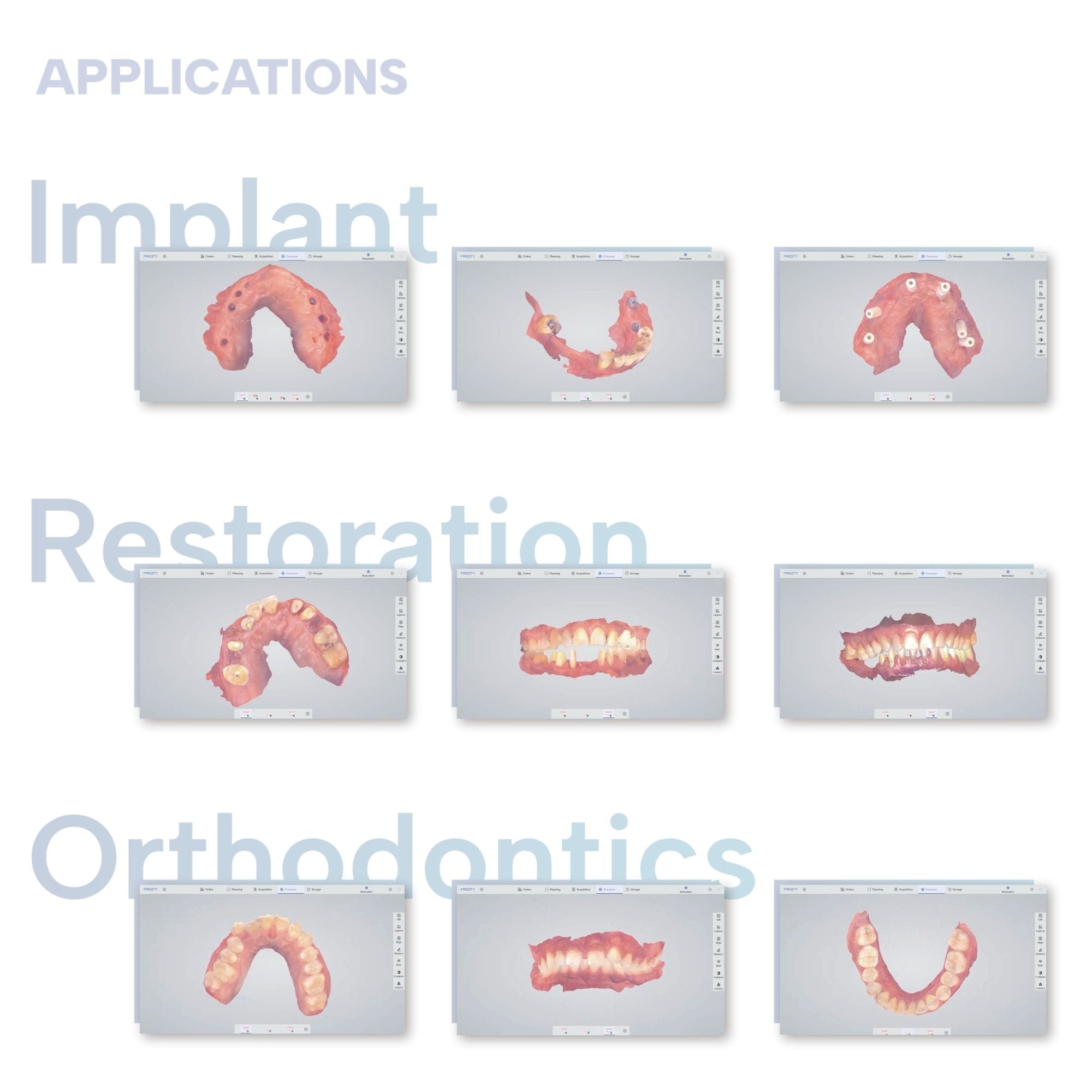 panda smart intraoral scanner lightweight application